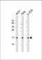 RPLP1 Antibody (N-Term)